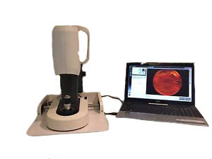 I-OPTICS EasyScan视网膜成像SLO数字眼底相机